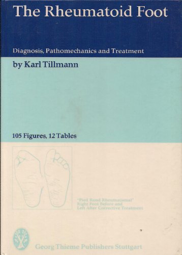 The Rheumatoid Foot