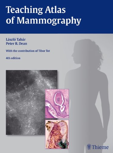 Beispielbild fr Teaching Atlas of Mammography (R FO-Ergänzungsbände) zum Verkauf von BooksRun