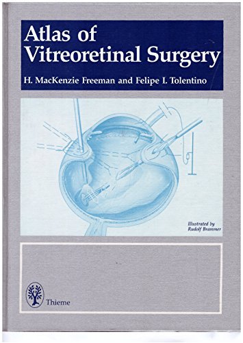 Atlas of Vitreoretinal Surgery (Atlas of Ophthalmic Surgery)