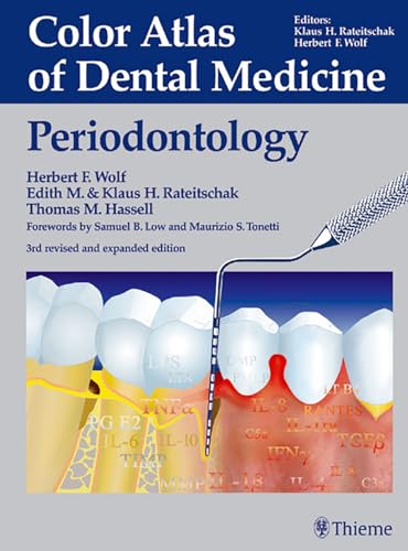 9783136750032: Color Atlas of Dental Medicine: Periodontology (Color atlas dent med)