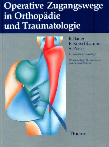 Imagen de archivo de Operative Zugangswege in der Orthopdie und Traumatologie [Gebundene Ausgabe] Medizin Pharmazie Klinik Praxis Chirurgie Operation Orthopde Orthopdische Chirurgie Indikationen anatomische Varianten Operationssituationen Zugangstechniken Unfallchirurgie chirurgiebezogene topografische Anatomie Indikationen Gefahren Komplikationsmglichkeiten arthroskopische Zugnge Zugangswege Indikationen Operation anatomische Varianten Operationssituationen Zugangsatlas fr Orthopden und Unfallchirurgen Bauersche Operationslehre Orthopdie Unfallchirurgie Leitungsbahnen anatomischer Situs Tumoren Orthopdische Technik Dietrich Hohmann Ralf Uhlig Lennart Mannerfelt Diagnose medizinisch psychiatrisch Diagnostik (medizinisch psychiatrisch Frhdiagnose Orthopdie Thieme Georg Verlag Illustrationen Gerhard Spitzer Zusatzinfo 593 farb. Zeichn. Sprache deutsch Mae 230 x 310 mm Gewicht 2165g Einbandart gebunden Geisteswissenschaften Rudolf Bauer (Autor), Fridun Kerschbaumer (Autor), Sepp Poisel a la venta por BUCHSERVICE / ANTIQUARIAT Lars Lutzer