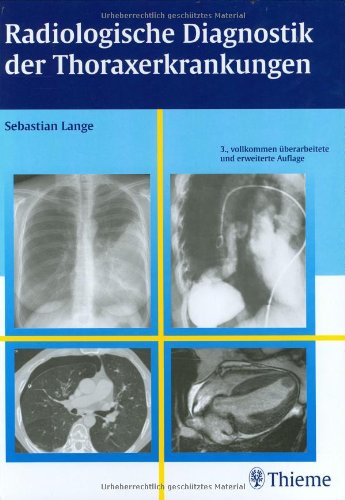 Beispielbild fr Radiologische Diagnostik der Thoraxerkrankungen (Gebundene Ausgabe) von Sebastian Lange zum Verkauf von BUCHSERVICE / ANTIQUARIAT Lars Lutzer