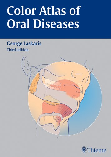 9783137170037: Color Atlas of Oral Diseases