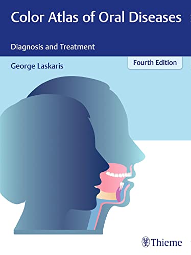 9783137170044: Color Atlas of Oral Diseases: Diagnosis and Treatment