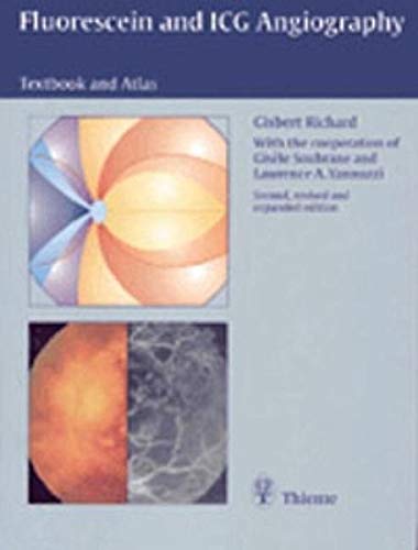 Imagen de archivo de Florescein and ICG Angiography: Textbook and Atlas a la venta por Mispah books