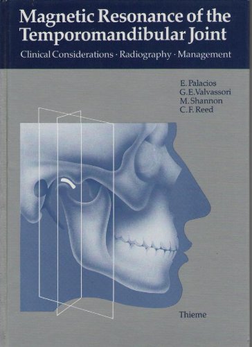 Imagen de archivo de Magnetic Resonance of the Temporomandibular Joint: Clinical Considerations, Radiography, Management a la venta por HPB-Red