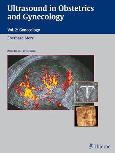 9783137544029: Ultrasound in Obstetrics and Gynecology: Volume 2: Gynecology