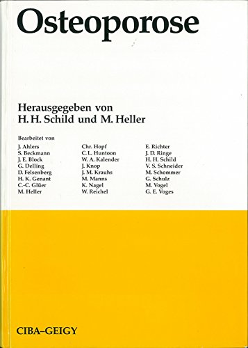 Beispielbild fr Osteoporose. zum Verkauf von Grammat Antiquariat