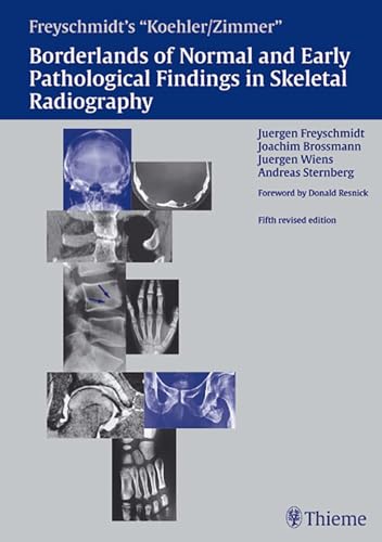 9783137841050: Freyschmidt's "Koehler/Zimmer" Borderlands of Normal and Early Pathological Findings in Skeletal Radiography