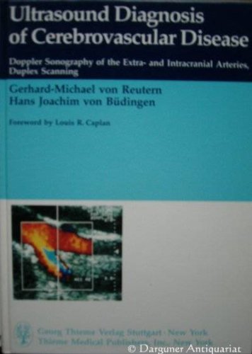 9783137844013: Ultrasound diagnosis of cerebrovascular disease: Doppler sonography of the extra- and intracranial arteries duplex scanning