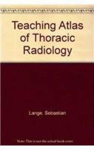 Teaching atlas of thoracic radiology (9783137917014) by Lange