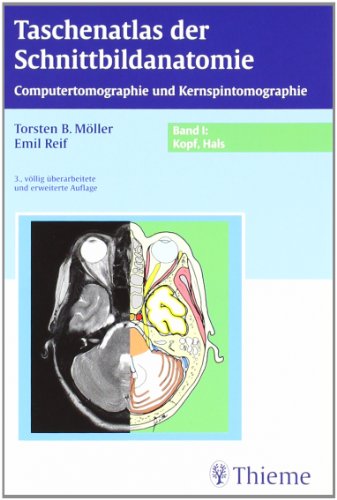 Stock image for Taschenatlas der Schnittbildanatomie. Computertomographie und Kernspintomographie: Taschenatlas der Schnittbildanatomie 1. Kopf, Hals: BD 1 for sale by medimops