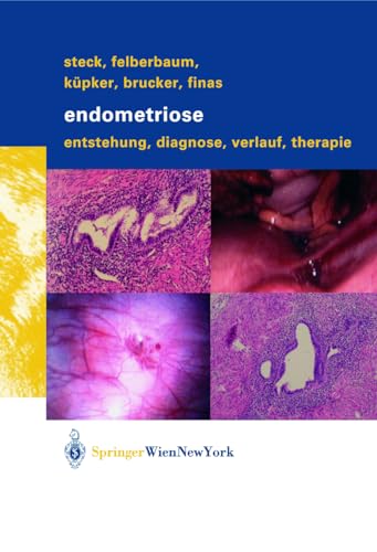 9783211007464: Endometriose: Entstehung, Diagnose, Verlauf Und Therapie