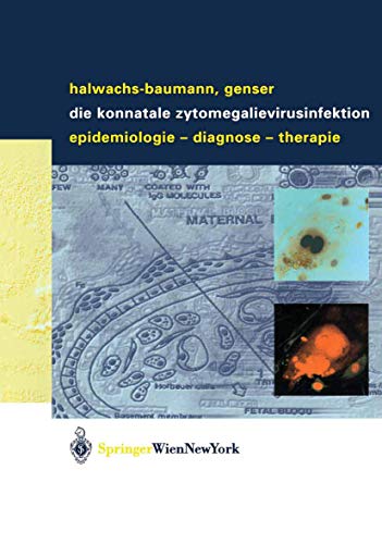 Die konnatale Zytomegalievirusinfektion: Epidemiologie - Diagnose - Therapie (German Edition) (9783211008010) by Halwachs-Baumann, Gabriele; Genser, Bernd