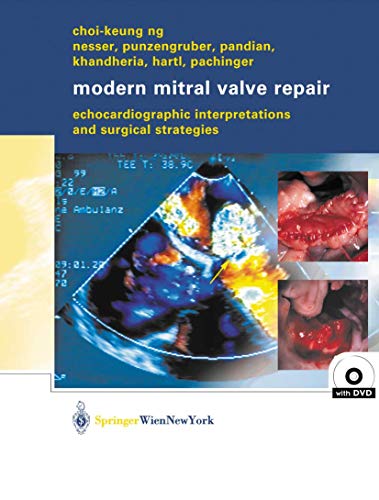 9783211008607: Modern Mitral Valve Repair: Echocardiographic Interpretations and Surgical Strategies