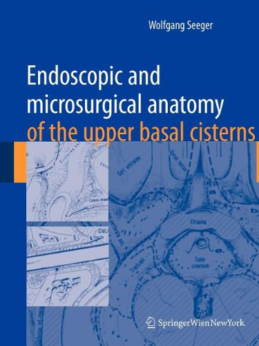 Endoscopic and microsurgical anatomy of the upper basal cisterns (9783211101872) by Seeger, Wolfgang