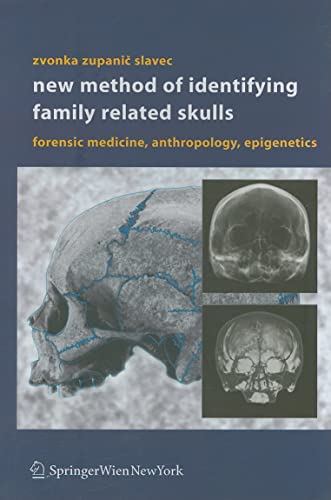 Beispielbild fr New Method of Identifying Family Related Skulls. Forensic Medicine, Anthropology, Epigenetics zum Verkauf von Buchhandlung Gerhard Hcher