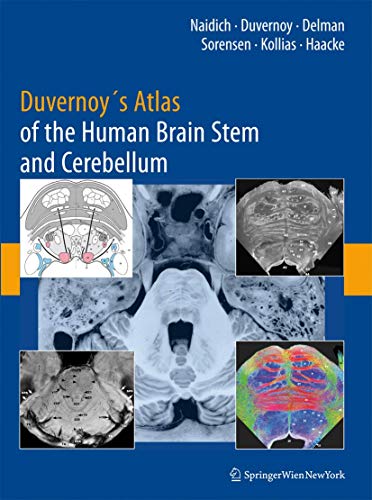 Duvernoy's Atlas of the Human Brain Stem and Cerebellum: High-Field MRI, Surface Anatomy, Internal Structure, Vascularization and 3 D Sectional Anatomy - P. Naidich, Thomas, Henri M. Duvernoy Bradley N. Delman a. o.