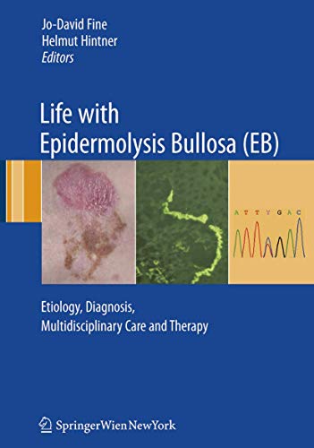 9783211792704: Life with Epidermolysis Bullosa (EB): Etiology, Diagnosis, Multidisciplinary Care and Therapy