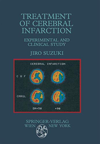 9783211819333: Treatment of Cerebral Infarction: Experimental and Clinical Study