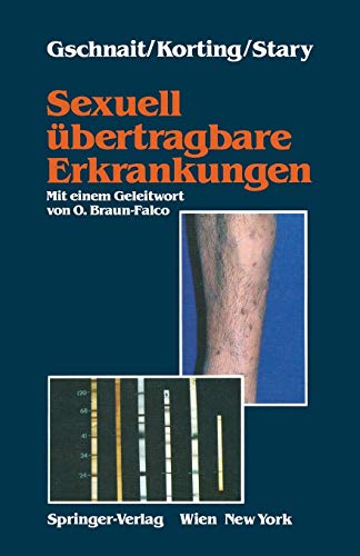 Stock image for Sexuell bertragbare Erkrankungen (German Edition) for sale by Lucky's Textbooks