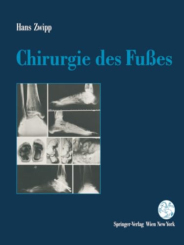 Chirurgie des Fußes.