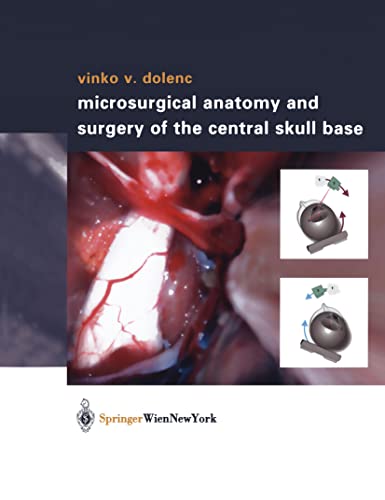 Stock image for Microsurgical Anatomy and Surgery of the Central Skull Base for sale by Phatpocket Limited