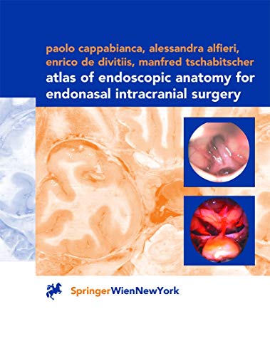 Stock image for Atlas of Endoscopic Anatomy for Endonasal Intracranial Surgery for sale by Phatpocket Limited