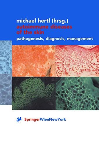 9783211835982: Autoimmune Diseases of the Skin: Pathogenesis, Diagnosis, Management