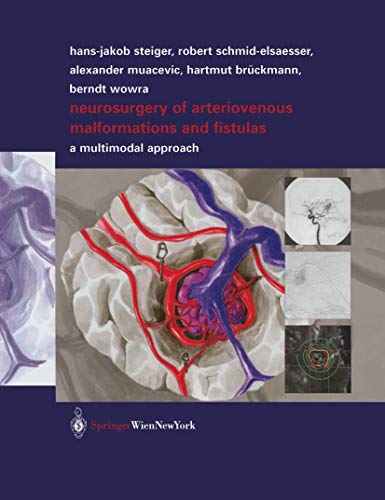 Stock image for Neurosurgery of Arteriovenous Malformations and Fistulas: A Multimodal Approach for sale by Revaluation Books