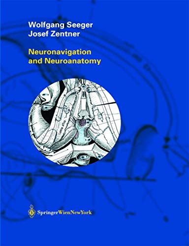 Neuronavigation and Neuroanatomy (9783211837412) by Josef Zentner Wolfgang Seeger