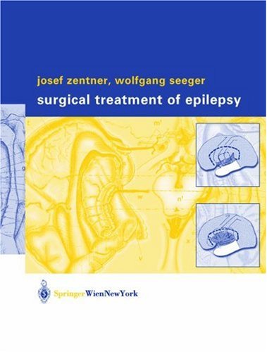 Surgical Treatment of Epilepsy (9783211837702) by Josef Zentner; Wolfgang Seeger