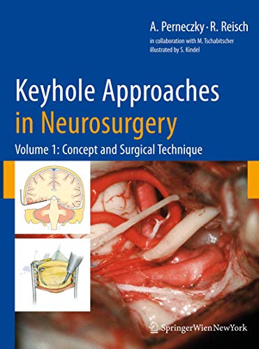 9783211838853: Keyhole Approaches in Neurosurgery: Concept and Surgical Technique: Volume 1: Concept and Surgical Technique