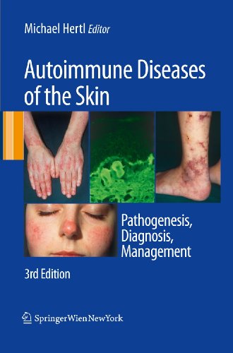 Imagen de archivo de Autoimmune Diseases of the Skin: Pathogenesis, Diagnosis, Management a la venta por Chiron Media