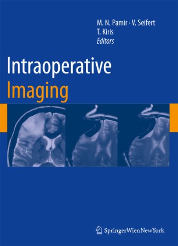 Imagen de archivo de Intraoperative Imaging 109 Acta Neurochirurgica Supplement a la venta por PBShop.store US