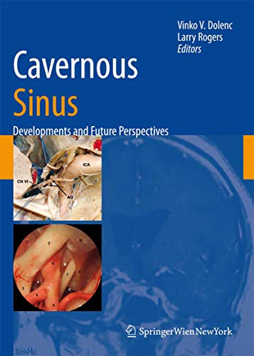9783211999011: Cavernous Sinus: Developments and Future Perspectives