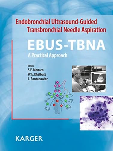 9783318023961: Endobronchial Ultrasound Guided Transbronchial Needle Aspiration (EBUS-TBNA): Cytomorphology and Atlas: A Practical Approach