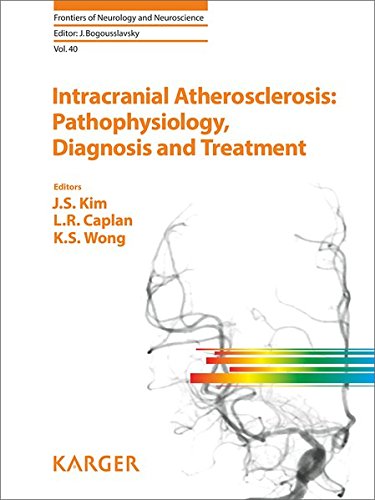 Imagen de archivo de Intracranial Atherosclerosis: Pathophysiology, Diagnosis And Treatment a la venta por Basi6 International