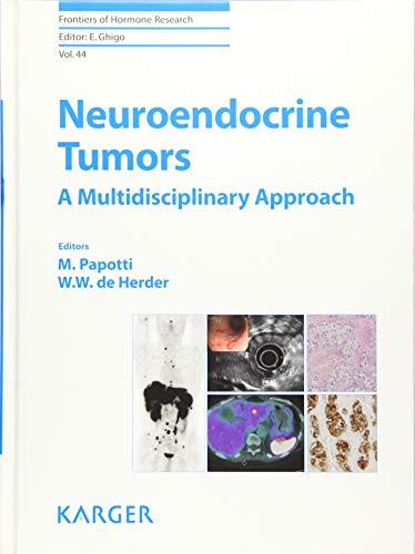 9783318027723: Neuroendocrine Tumors: A Multidisciplinary Approach (FRONTIERS OF HORMONE RESEARCH)
