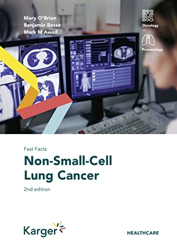 Imagen de archivo de Non-Small-Cell Lung Cancer a la venta por Blackwell's
