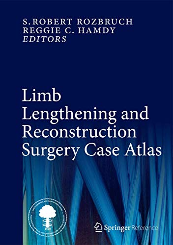 9783319036380: Limb Lengthening and Reconstruction Surgery Case Atlas