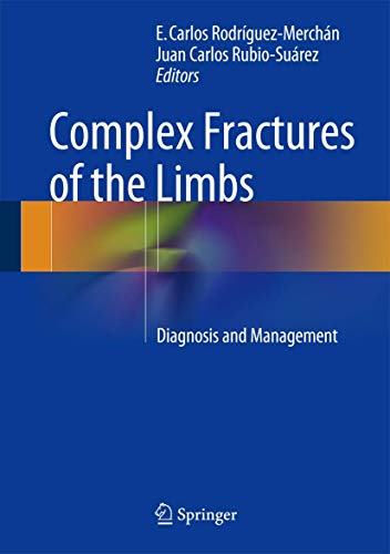 9783319044408: Complex Fractures of the Limbs: Diagnosis and Management
