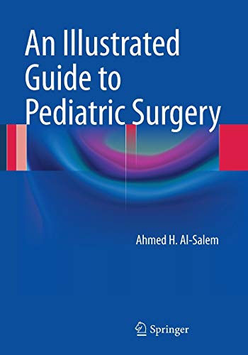 9783319066646: An Illustrated Guide to Pediatric Surgery