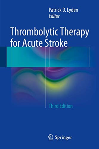 Thrombolytic Therapy for Acute Stroke.