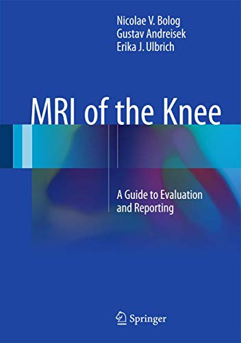 9783319081649: MRI of the Knee: A Guide to Evaluation and Reporting