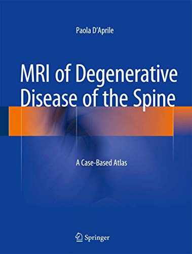 9783319094465: MRI of Degenerative Disease of the Spine: A Case-based Atlas