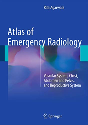 9783319130415: Atlas of Emergency Radiology: Vascular System, Chest, Abdomen and Pelvis, and Reproductive System