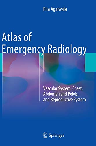 Stock image for Atlas of Emergency Radiology. Vascular System, Chest, Abdomen and Pelvis, and Reproductive System. for sale by Antiquariat im Hufelandhaus GmbH  vormals Lange & Springer