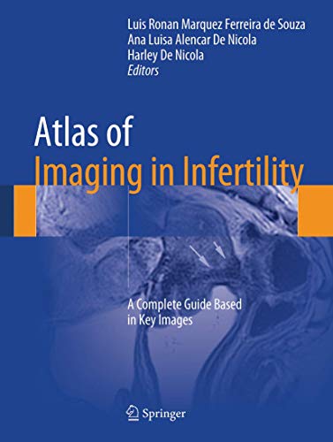 Beispielbild fr Atlas Of Imaging In Infertility A Complete Guide Based In Infertility (Hb 2017) zum Verkauf von Basi6 International