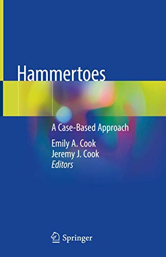 Beispielbild fr Hammertoes. A Case-Based Approach. zum Verkauf von Gast & Hoyer GmbH